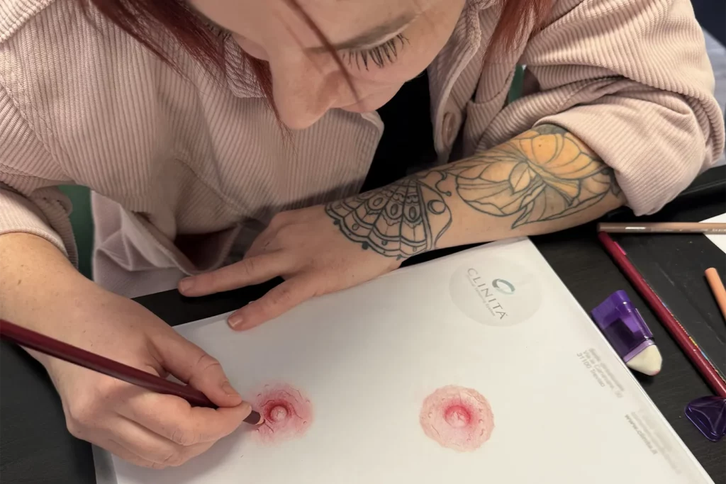 Areola Pigmentierung